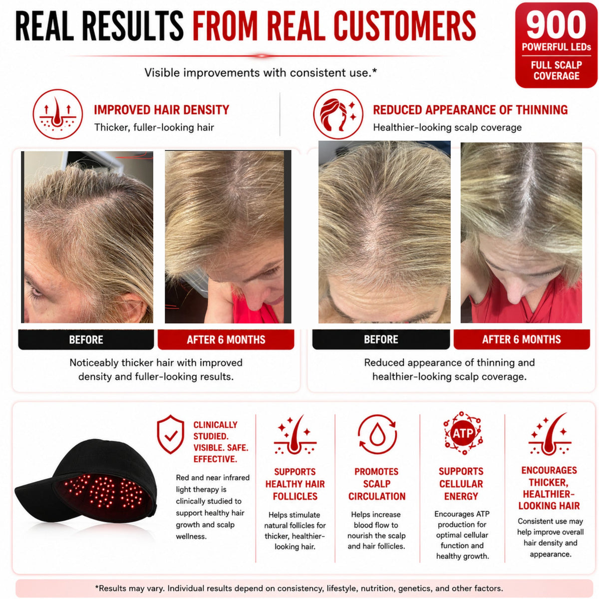 Red Light Pro Devices customer results graphic with before and after scalp photographs and brand benefit claims