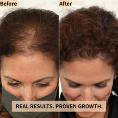 Nicebeam Red Light Therapy Hat before and after graphic comparing a woman's hair part