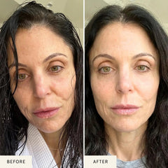 Before and after facial appearance comparison featuring an adult woman