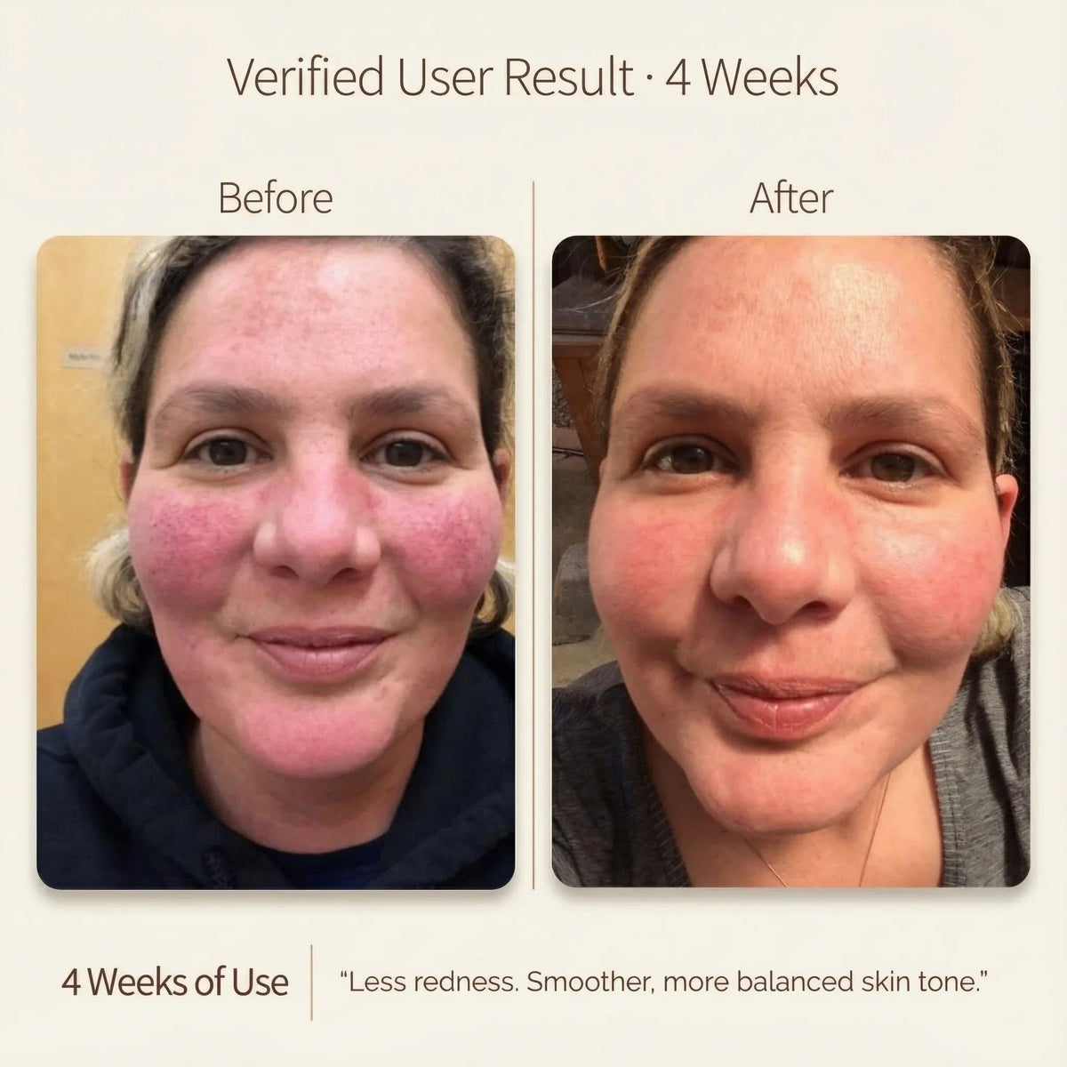Four week before and after facial appearance comparison from a verified user