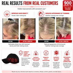 Red Light Pro Devices customer results graphic with before and after scalp photographs and brand benefit claims